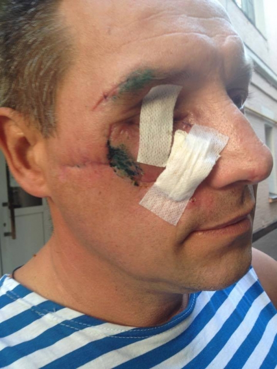 Украинские военные и добровольцы с травмами глаз могут обращаться за бесплатной помощью